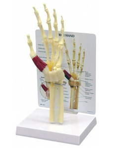 (미국GPI) 손목터널 증후군모형(G192)/ Hand/Wrist 192 Carpal Tunnel Syndrome