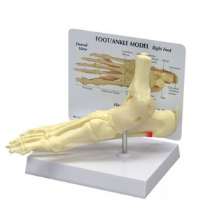 (미국GPI)발 근막염모형(G198)/ Ankle/Foot 198 - Plantar Fasciitis