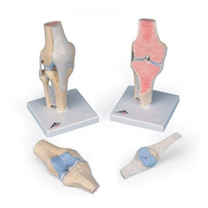 [3B]무릎관절단면 3분리(A89)/ Sectional knee joint model,3-part