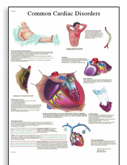 [3B]심장질환차트 Common Cardiac Disorders Chart/50 x 67 cm VR1343UU(비코팅)