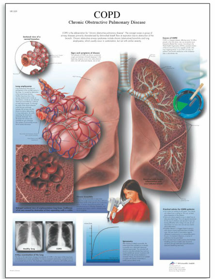 [3B]폐질환차트 COPD차트 COPD Chart- Chronic Obstructive Pulmonary Disease/50 x 67 cm VR1329UU(비코팅)